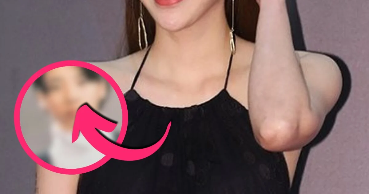 Popular Idol-Actress Was So Pretty In School, She Had To Shave Off Her Head